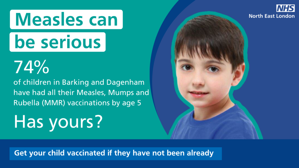 measles can be serious, get you child vaccinated